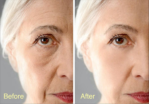 BeforeAndAfter.jpeg