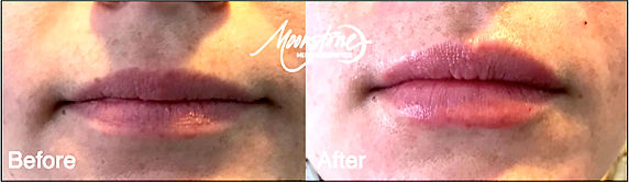 Lips.jpeg