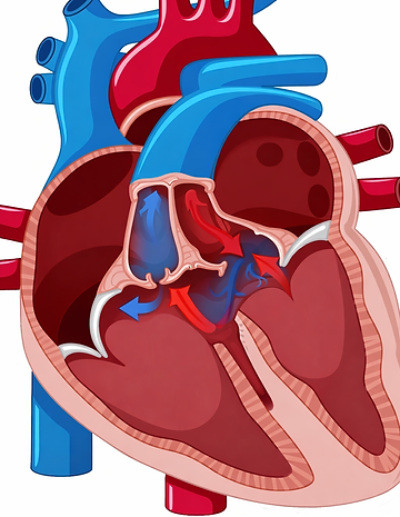 Atrioventrikulärer Septumdefekt.png