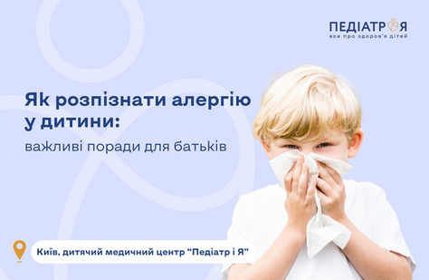 Як розпізнати алергію у дитини: важливі поради для батьків