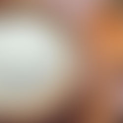 PREBIÓTICOS X PROBIÓTICOS