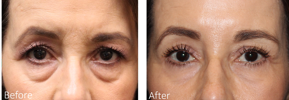 Best Plastic Surgeon Dallas