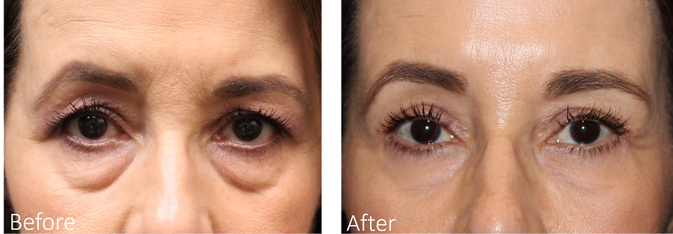 Best Dallas Plastic Surgeon