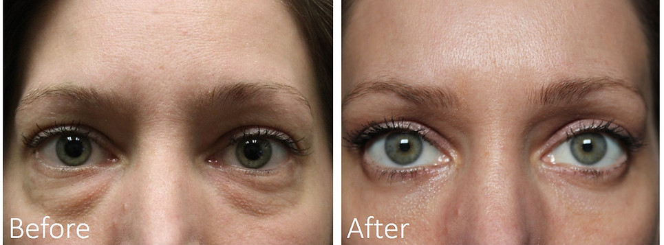 Best eye bag doctor