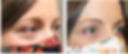 Best Eye Bag Surgeon