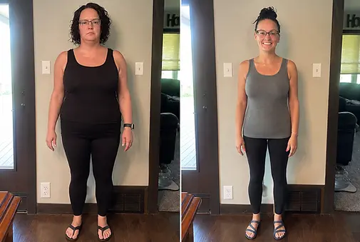 mirand-before-after.webp