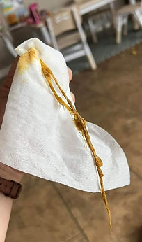 Parasite that came out of a young child