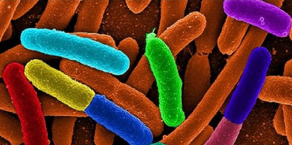 microbes 1.jpg