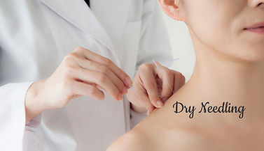 Dry Needling