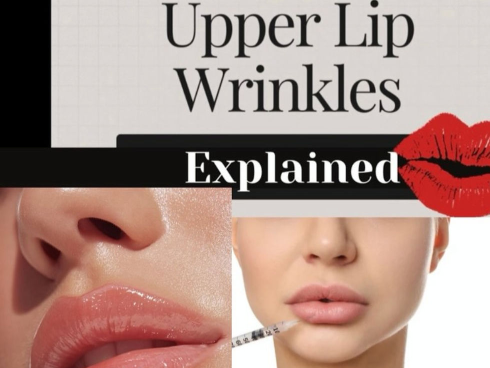 Lip Wrinkles: Causes, Prevention & The Best Treatments for Smoother Lips