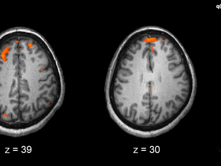 Increased Productivity (According to Neuroscience)
