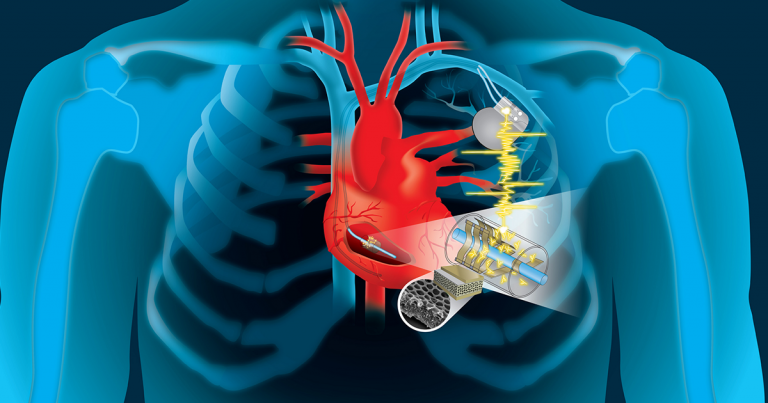 implant-cyborg-devices-heartbeat-768x403