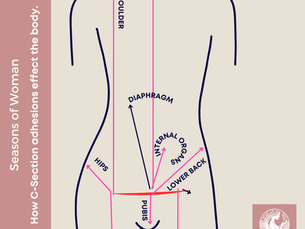 C-Section Scar Adhesions and their Impact on the Body