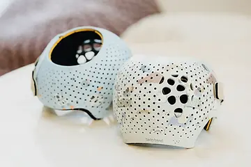 自由が丘ぶどうの木こどもクリニック ヘルメット治療