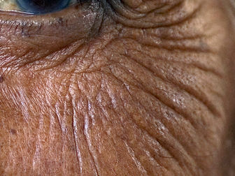 Researchers provide novel insights into human skin aging