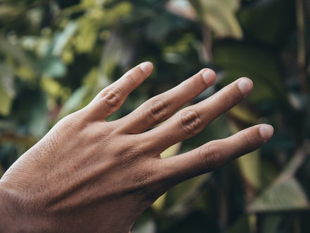 Tips for checking nails for melanoma