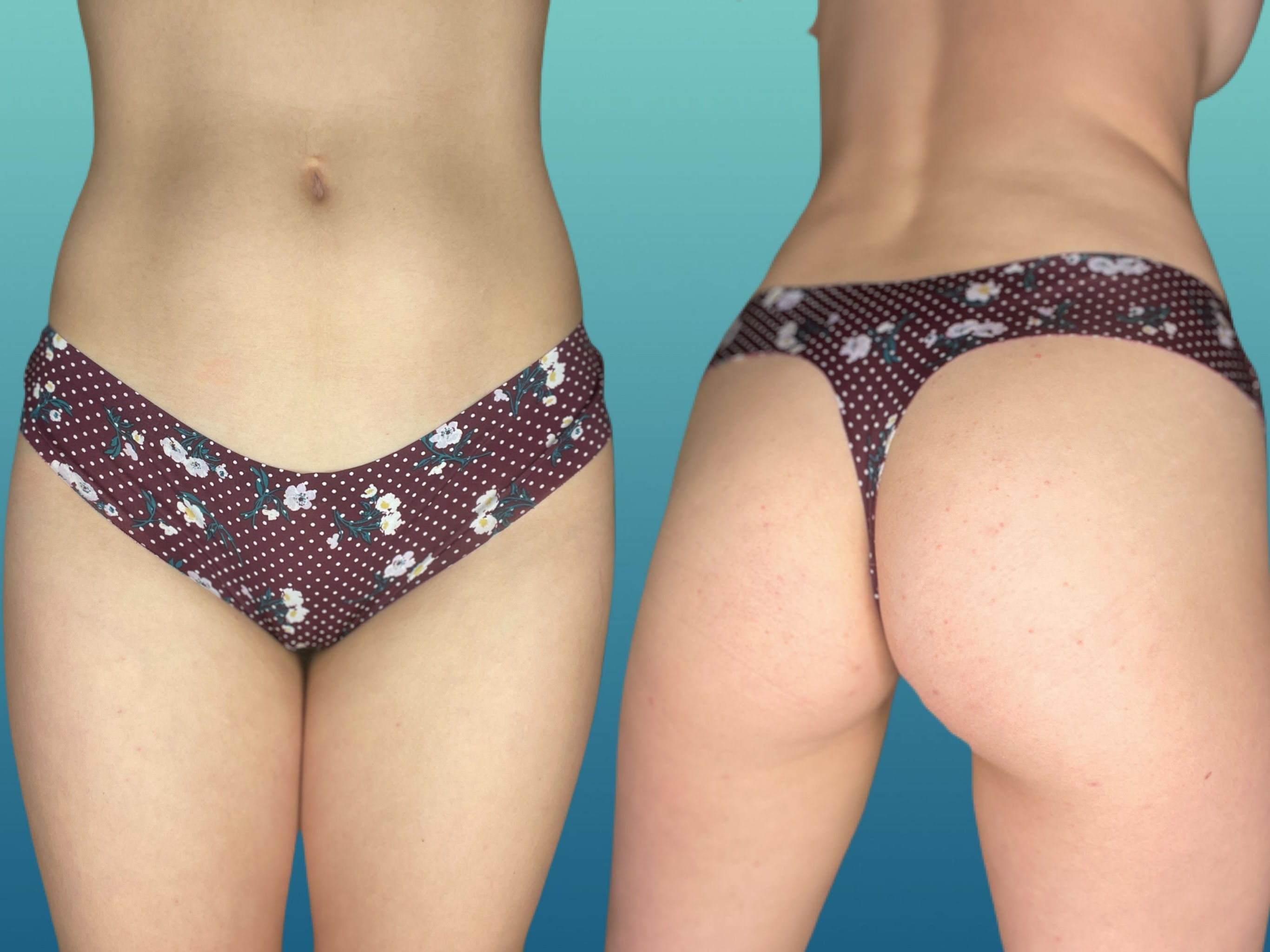 Purple Nylon Polka Dot Floral Thong