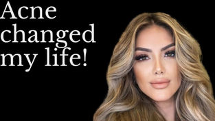 My personal battle with acne sparked a passion for skincare that forever changed my life.