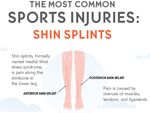 Medial Tibial Stress Sydrome