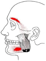 pain from TMJ
