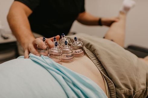 Cupping Therapy for Low Back Pain
