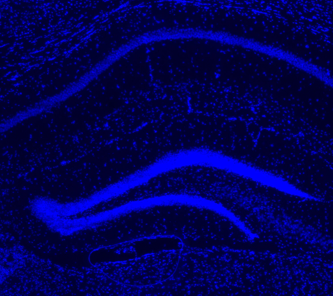 dapi.jpg