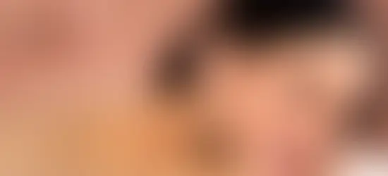 Acupuntura na Fertilidade e Saúde Feminina