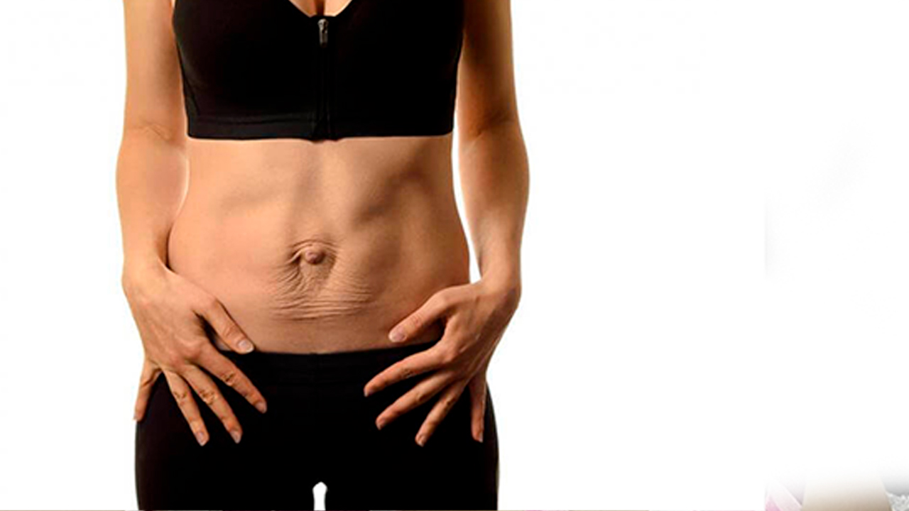Workshop registrato - DIASTASI ADDOMINALE: APPROCCIO TERAPEUTICO DI FISIOTERAPIA DERMATOFUNZIONALE