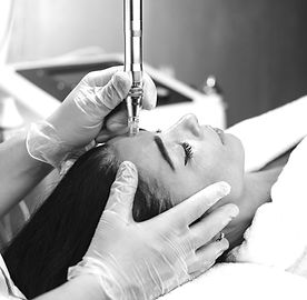 1 Microneedling_edited.jpg