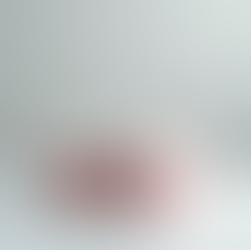 Affordable Low-Cost Dental Implants for Your Smile