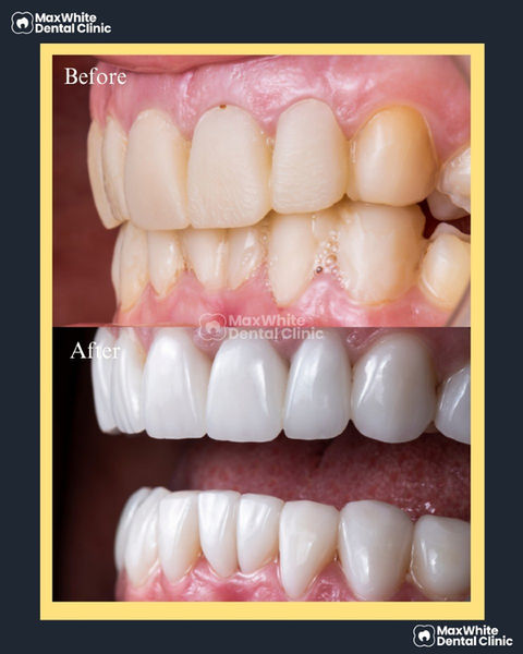 Before & After dental treatment
