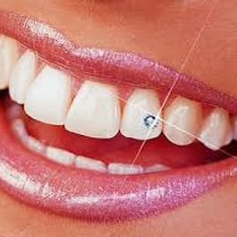 close-up smile with tooth jewellery on one of the tooth