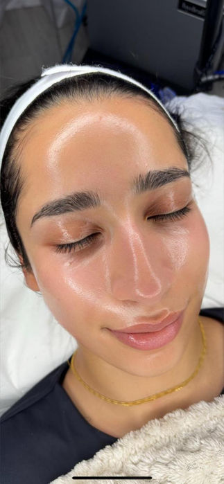 Deluxe Dermaplaning | Adeera Aesthetics