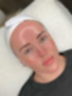Luxury Facials | Adeera Aesthetics