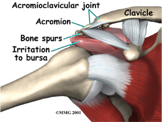 Why does my shoulder hurt so much?