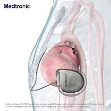 EV ICD LATERAL.jpeg