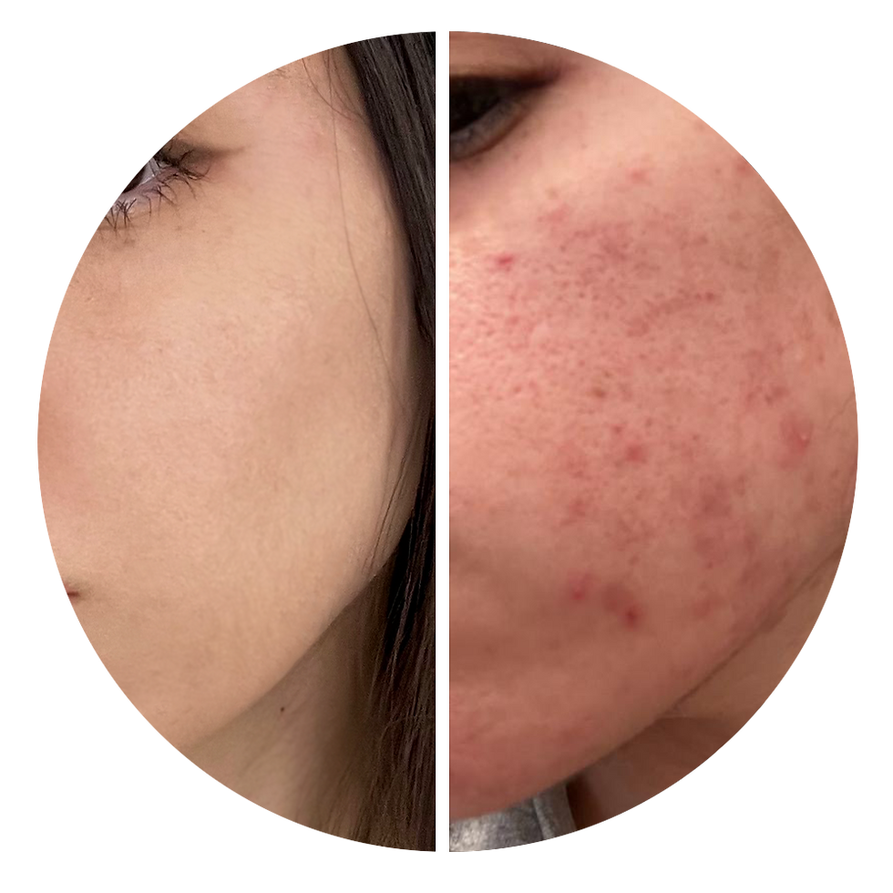 לפני ואחרי שינוי שגרת הטיפוח למוצרים שלא סותמים נקבוביות