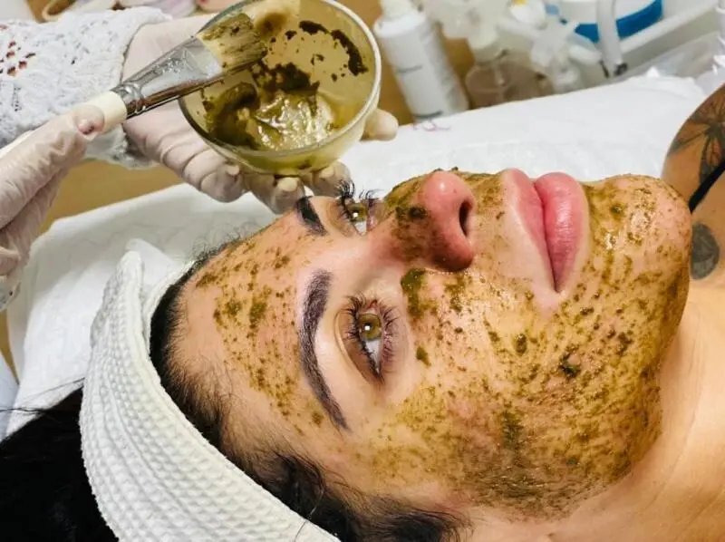 Procedimento é 100% natural com extrato de algas. Remove células mortas, promove renovação e afinamento intenso, com resultados de alto impacto. Estimula a produção de colágeno, elastina e ácido hialurônico, resultando em uma pele mais uniforme, com linhas e marcas de expressão reduzidas, textura suave, macia e viço saudável. Excelente aliado em diversos tratamentos corporais e faciais, como os de rejuvenescimento, tratamento de hipercromias e antiacne.