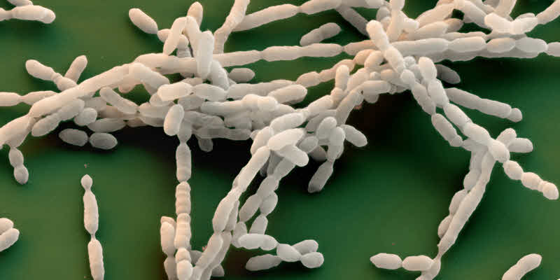 Oenococcus oeni al microscopio (https://www.foodnewslatam.com/)