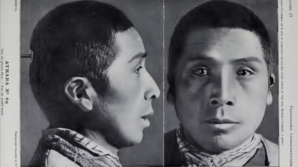 How Bolivian medicine viewed Indigenous people