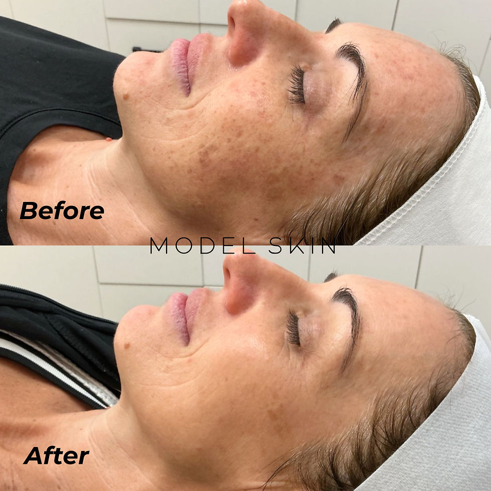 ELLIE MODEL SKIN DESIGNS (Instagram Post).png.jpeg