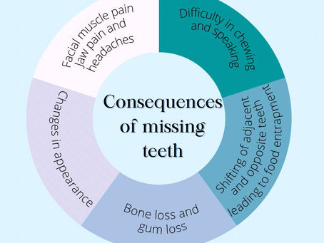 CONSEQUENCES OF MISSING TEETH