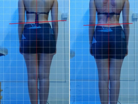 Seitai & New Seitai - Método do Prof. Adriano SaranTerapia Você vê os resultados antes e depois