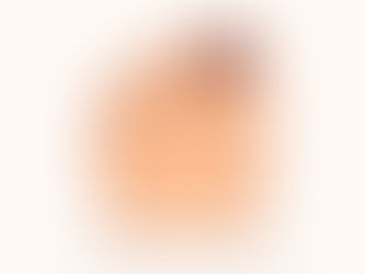 Black toenail without injury subungual hematoma dark toenail causes nail discoloration big toe