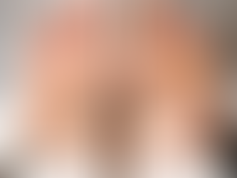 Healthy vs unhealthy feet comparison showing smooth hydrated skin versus dry cracked skin with calluses and thickened areas.