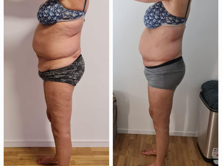 Abnehmen im Liegen und Multiple Sklerose – sanfte Unterstützung für mehr Wohlbefinden