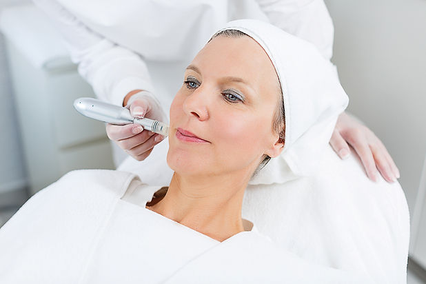 Microneedling_Frankfurt.jpg