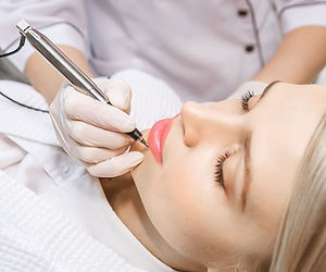 Laser PMU and Body tattoo removal