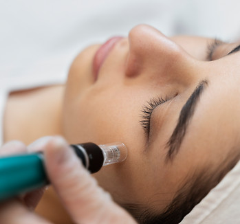 person-getting-micro-needling-beauty-treatment.jpg