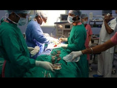 Médicos retiram 40 facas de barriga de indiano: "curtia o gosto"